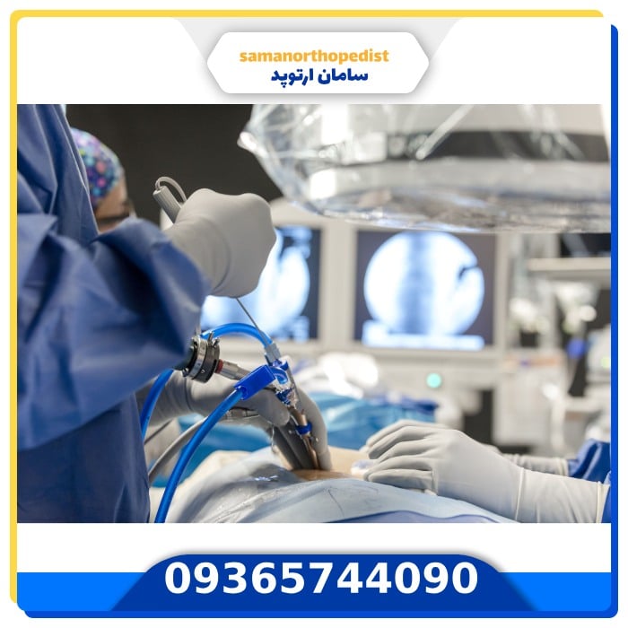 عمل جراحی ستون فقرات