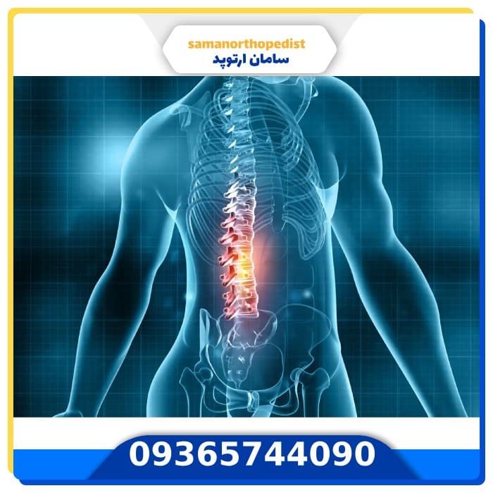 عمل جراحی ستون فقرات