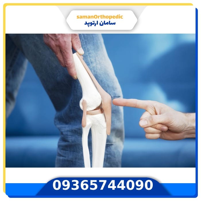 عمل جراحی مفصل زانو