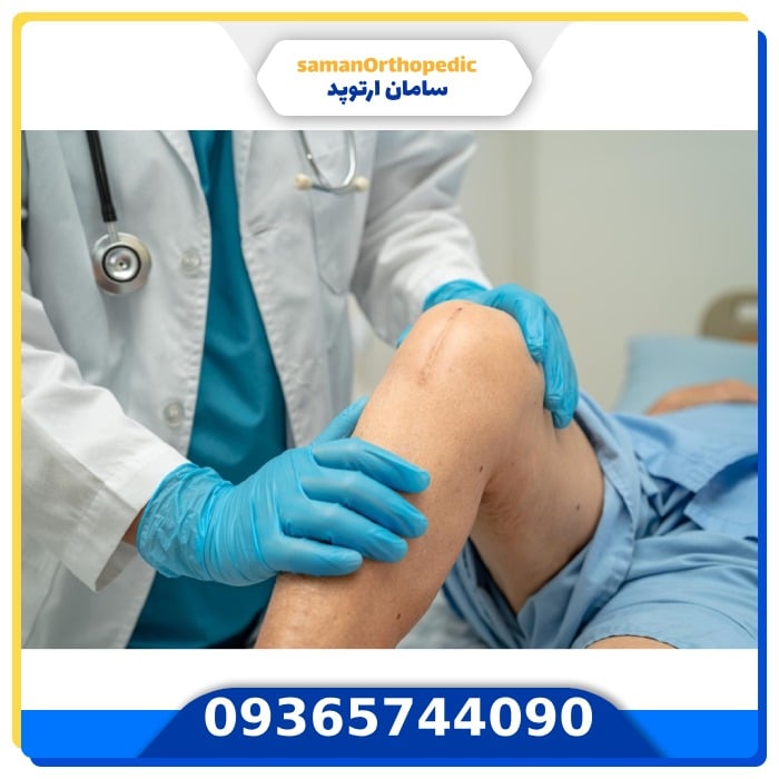 عمل جراحی مفصل زانو