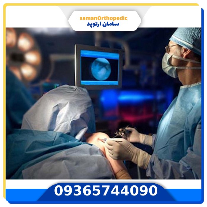 عمل جراحی مفصل شانه