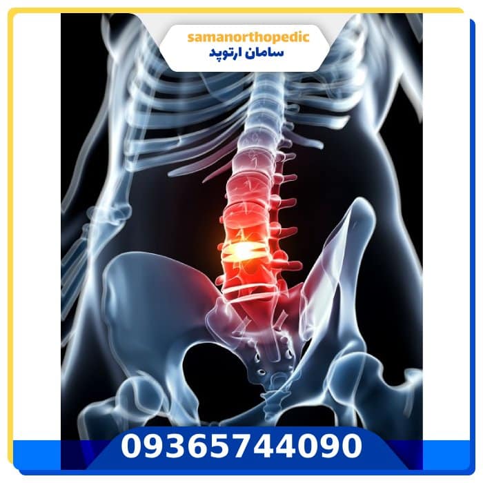 عمل جراحی ستون فقرات