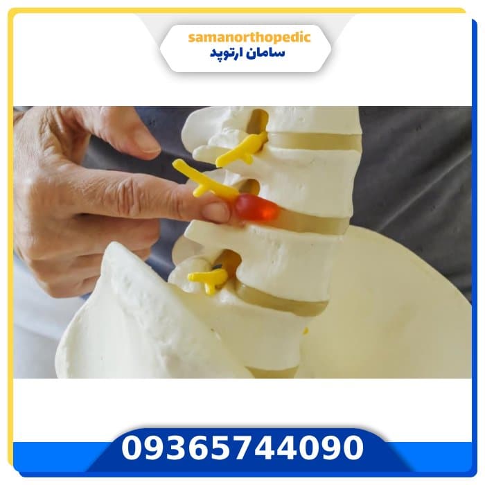 عمل جراحی ستون فقرات