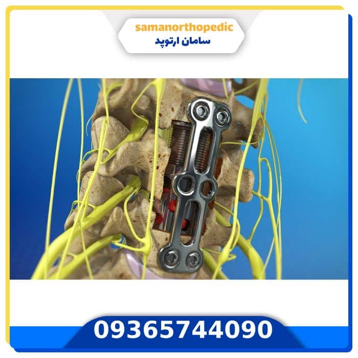 عمل جراحی دیسک کمر