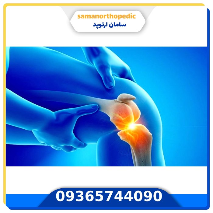 عمل جراحی مجدد مفصل زانو