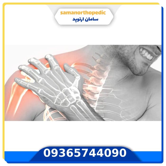 عمل جراحی مفصل شانه