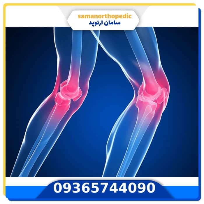 بهترین مارک پروتز مفصل زانو