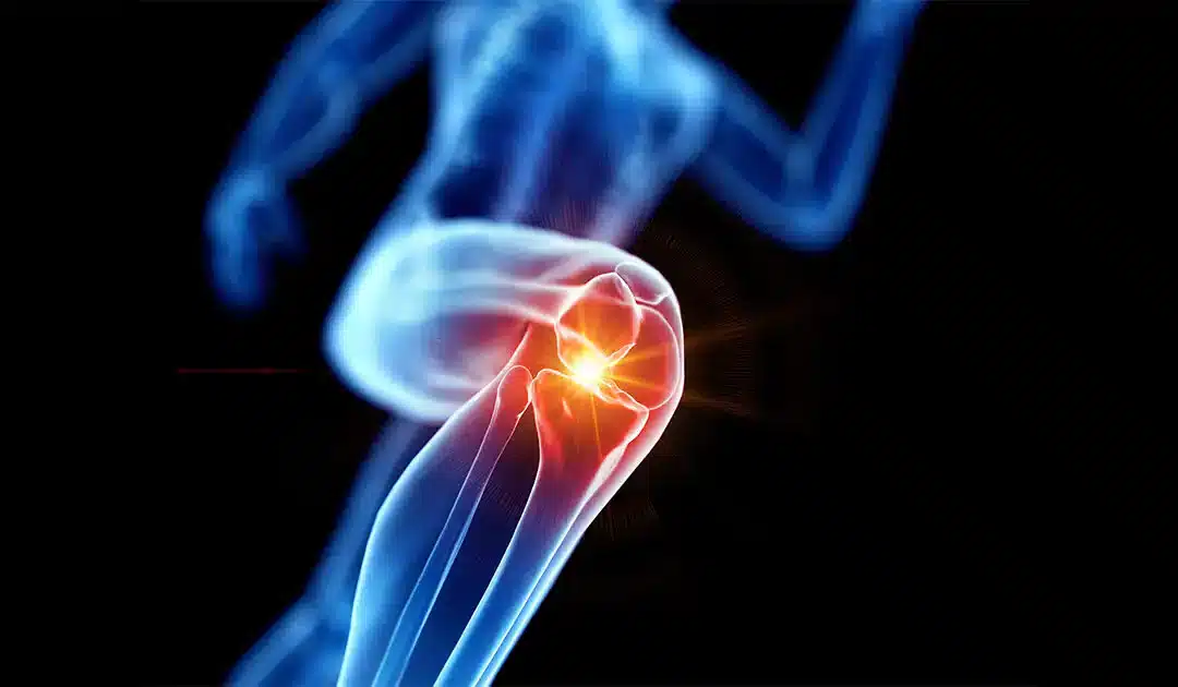 آموزش تزریق داخل مفصل زانو تزریق داخل مفصل زانو