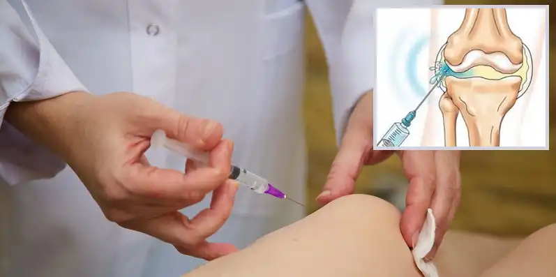 تزریق ژل داخل مفصل زانو تزریق ژل داخل مفصل زانو