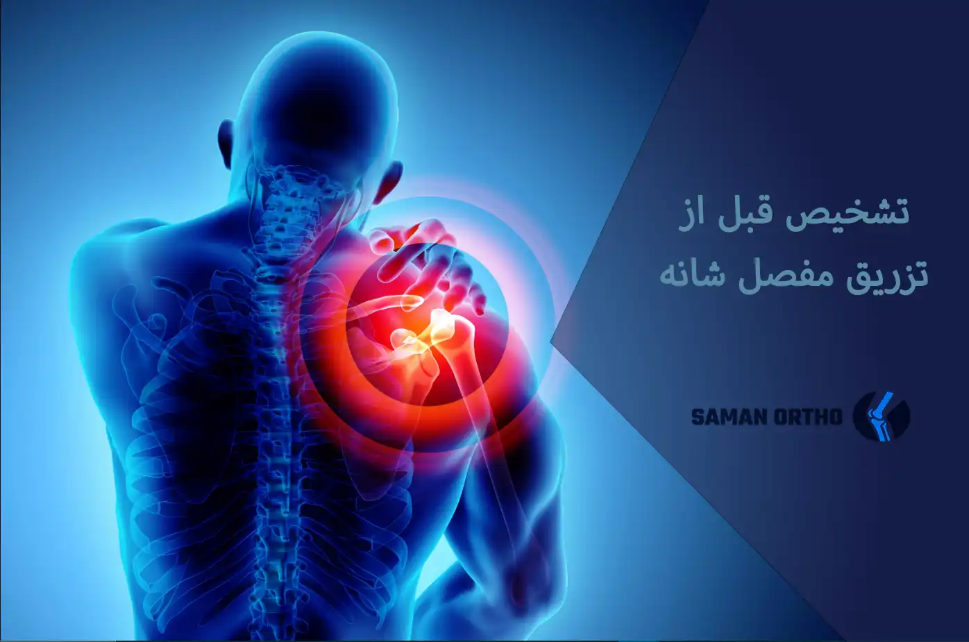 تزریق مفصل شانه تزریق مفصل شانه