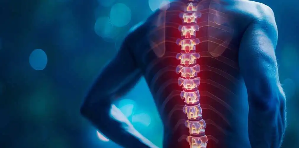 همانژیوم ستون فقرات چیست؟ همانژیوم ستون فقرات