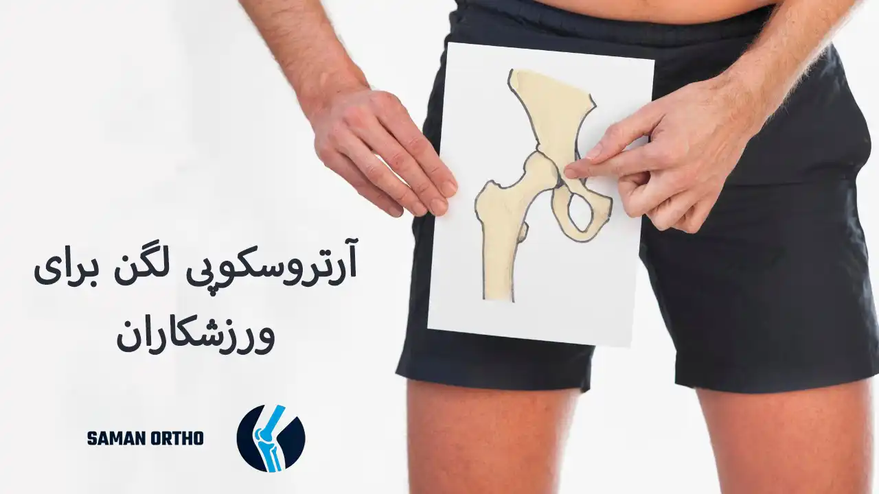 آرتروسکوپی لگن چیست؟ | راهنمای کامل و انتخابی آسان، هوشمندانه و کمخطر برای بیماران آرتروسکوپی لگن