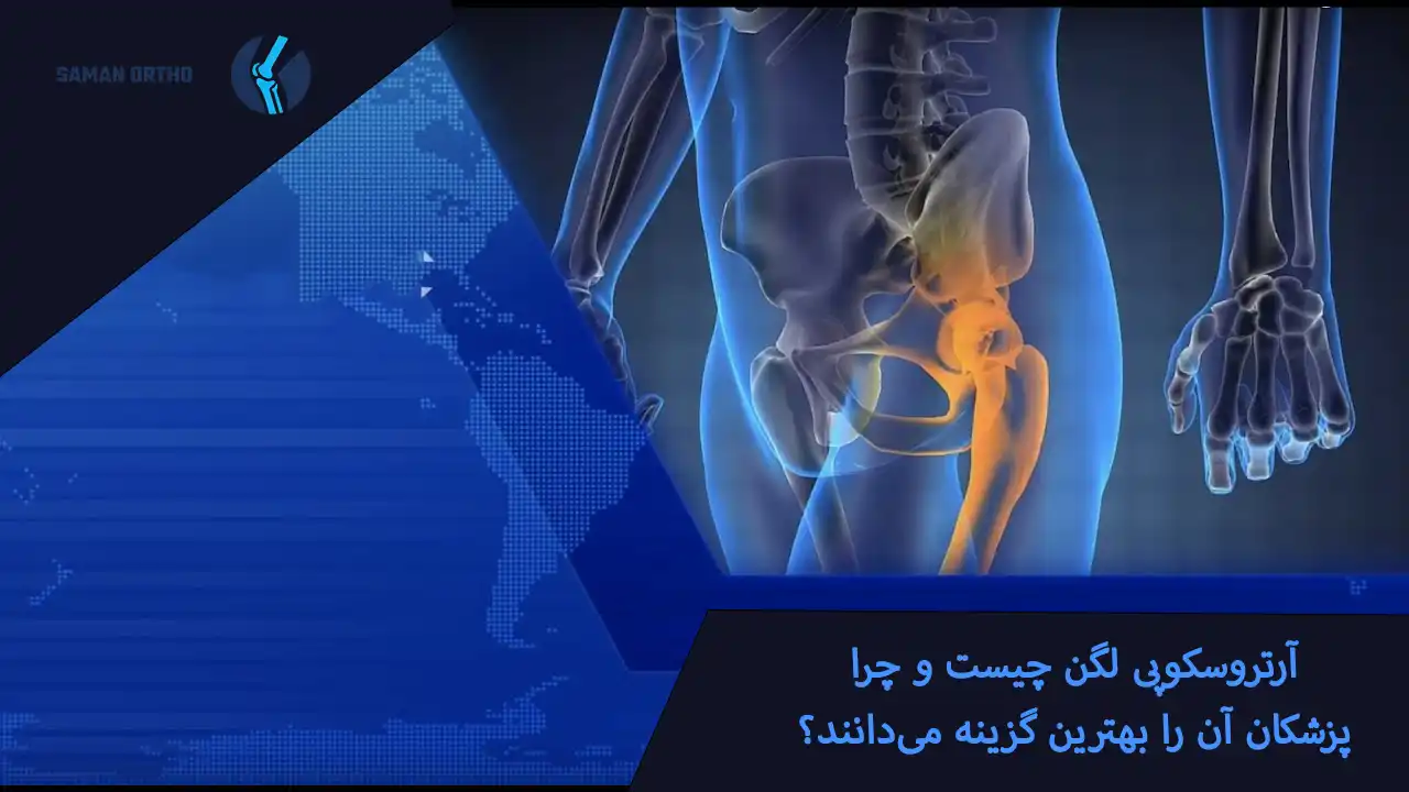 آرتروسکوپی لگن چیست؟ | راهنمای کامل و انتخابی آسان، هوشمندانه و کمخطر برای بیماران آرتروسکوپی لگن