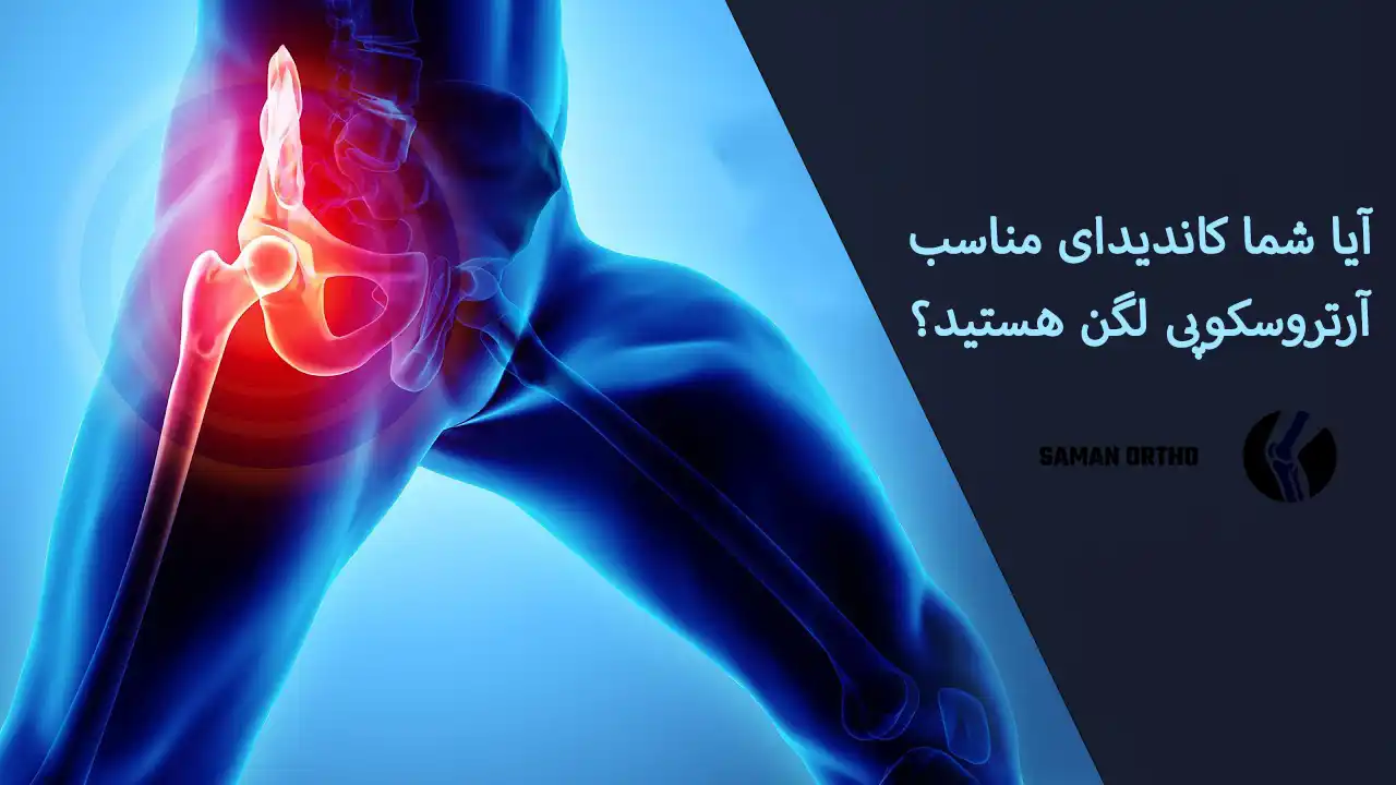 آرتروسکوپی لگن چیست؟ | راهنمای کامل و انتخابی آسان، هوشمندانه و کمخطر برای بیماران آرتروسکوپی لگن