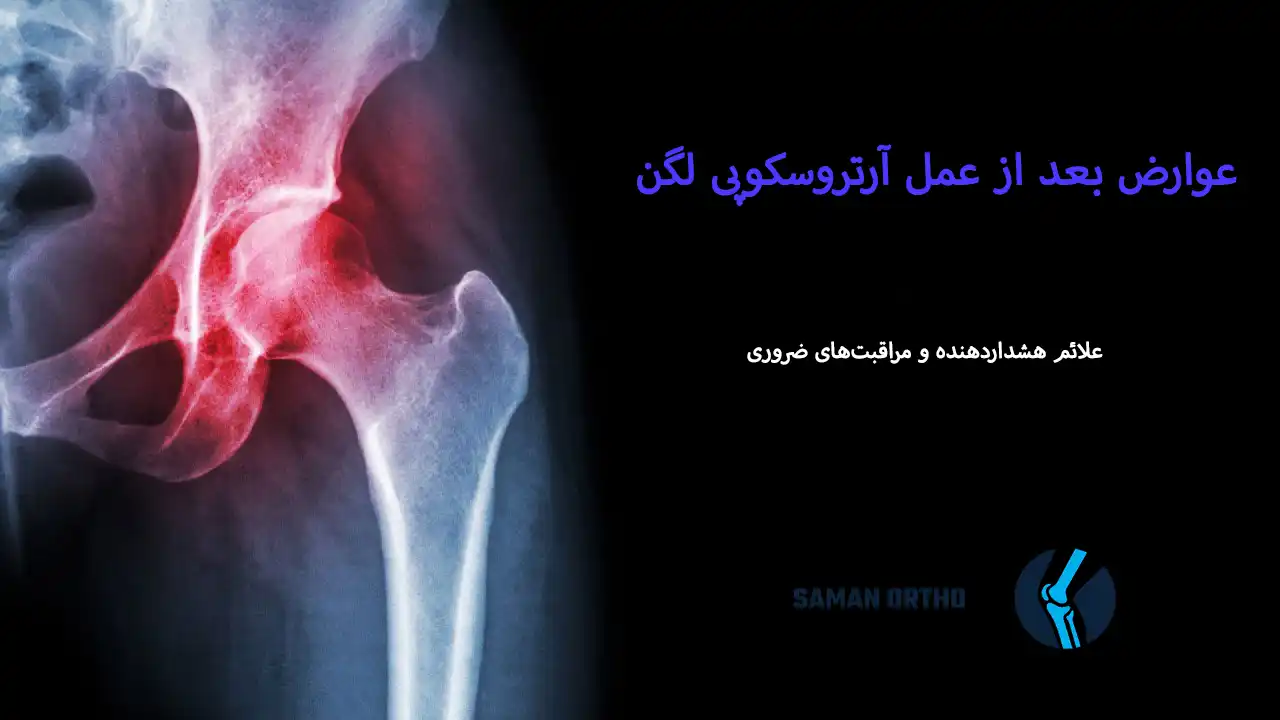 آرتروسکوپی لگن چیست؟ | راهنمای کامل و انتخابی آسان، هوشمندانه و کمخطر برای بیماران آرتروسکوپی لگن