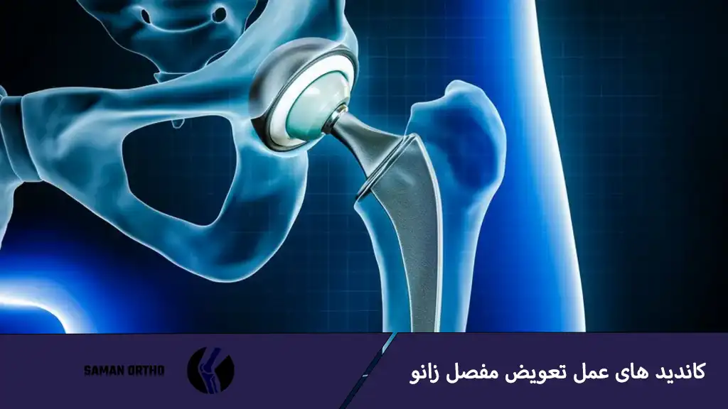 عمل آرتروپلاستی لگن یا تعویض مفصل ران برای کاهش درد و بازیابی حرکت مفصل لگن