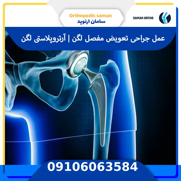 عمل جراحی تعویض مفصل لگن