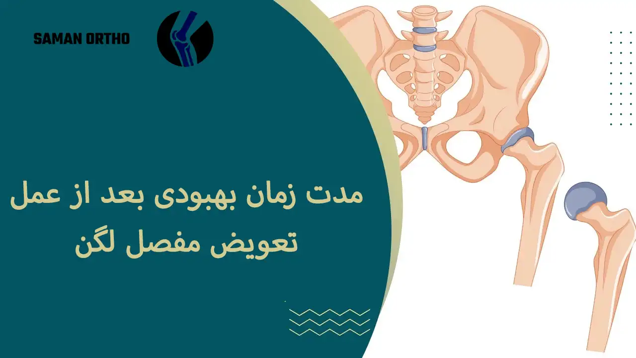 عمل آرتروپلاستی لگن یا تعویض مفصل ران 