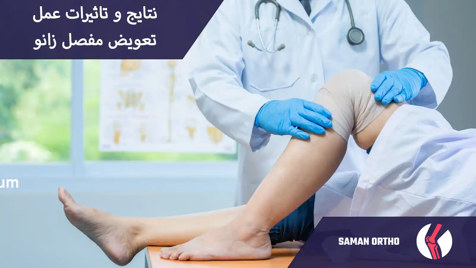 عمل جراحی تعویض مفصل زانو | آرتروپلاستی زانو جراحی تعویض مفصل زانو