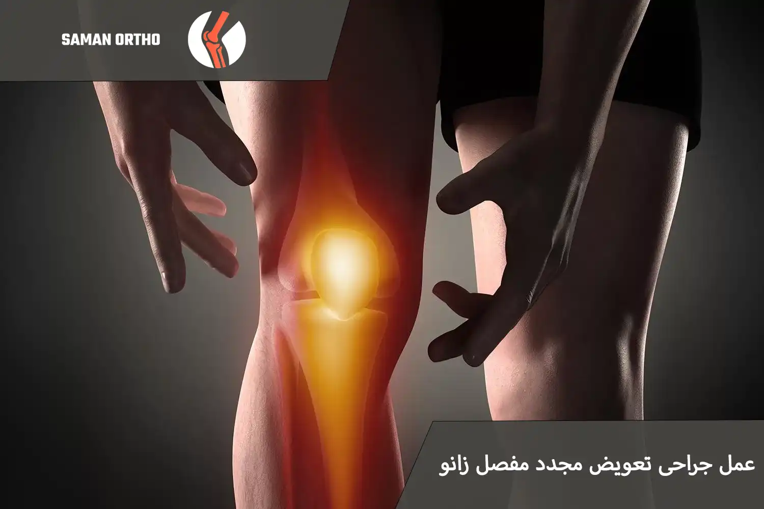 عمل جراحی تعویض مجدد مفصل زانو | زمان خداحافظی پروتز زانو فرا رسیده است! عمل تعویض مجدد مفصل زانو