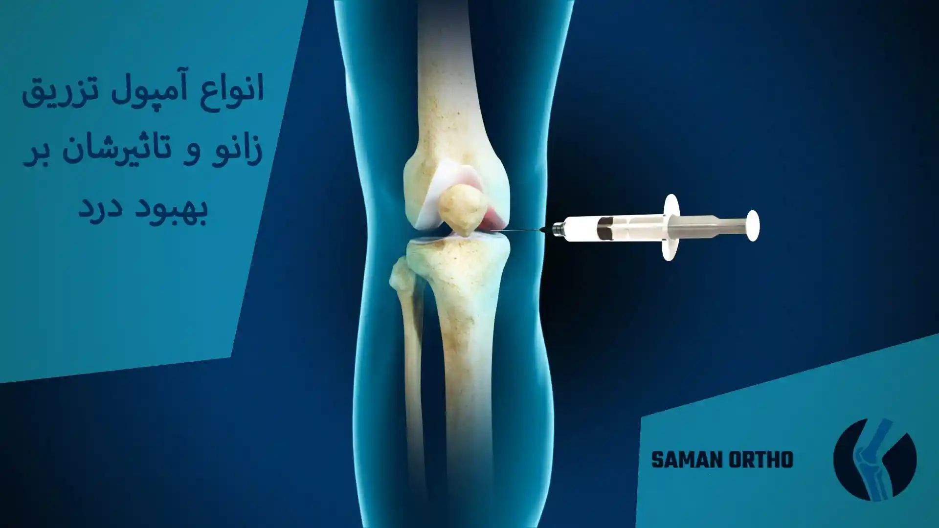 کیا بعد تزریق آمپول به زانو خوب شدن