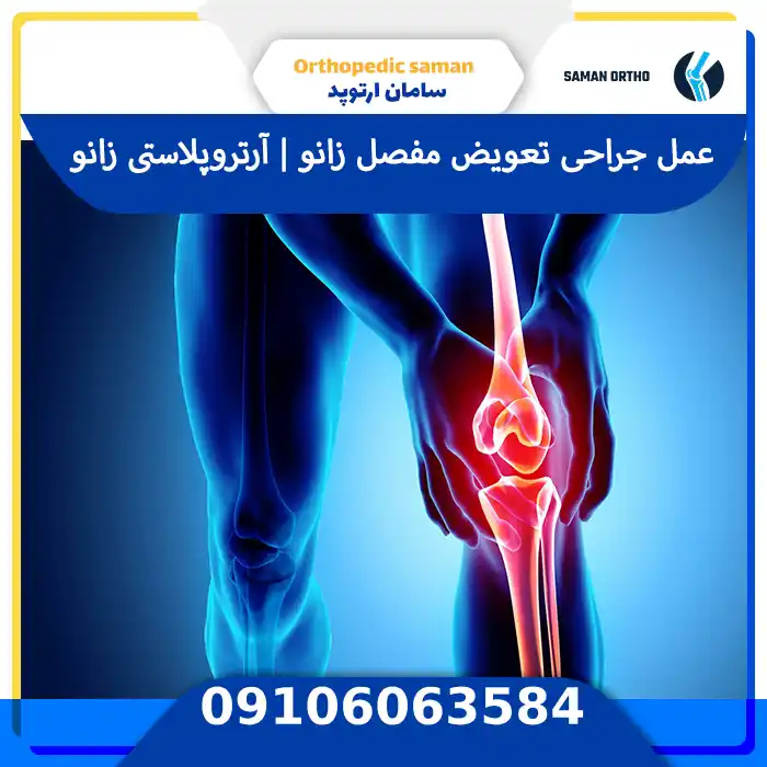 عمل جراحی تعویض مفصل زانو یا آرتروپلاستی زانو برای کاهش درد و بازیابی حرکت مفصل در بیماران مبتلا به آرتروز یا آسیب مفصلی