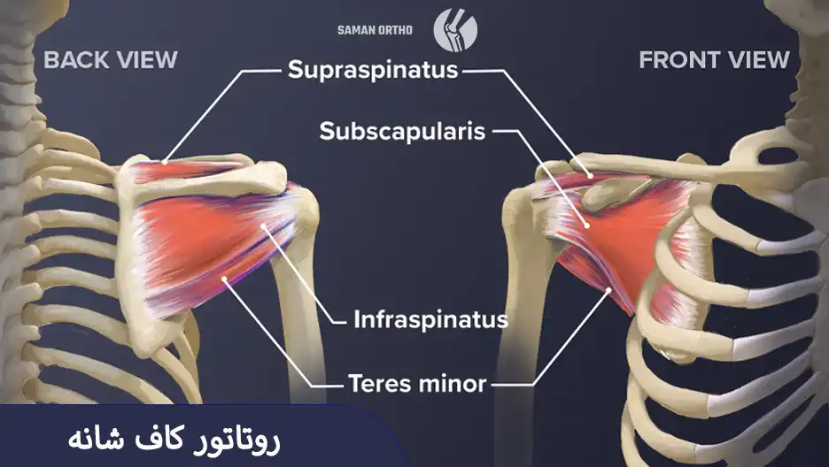 روتاتورکاف شانه و محل پارگی تاندون‌ها در مفصل شانه