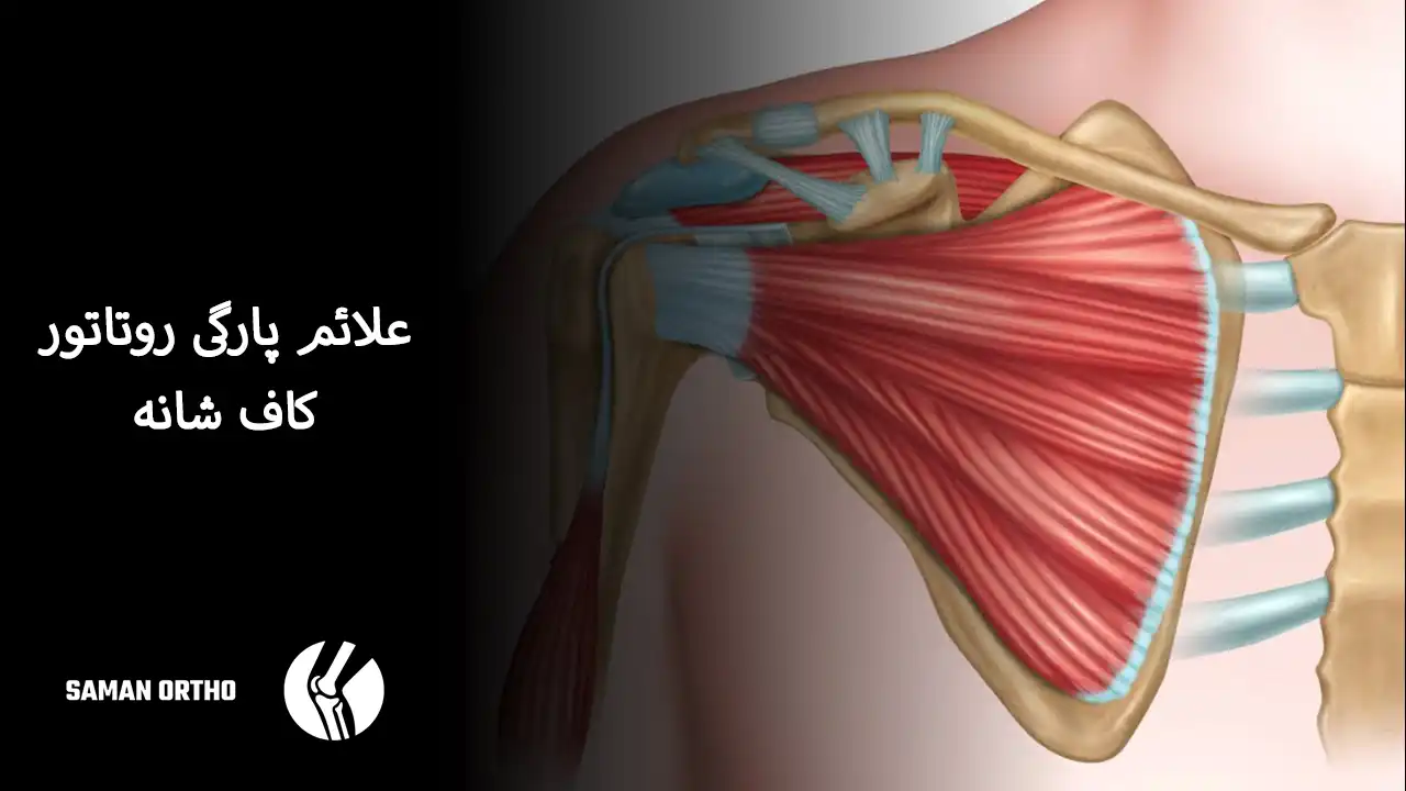 روتاتورکاف شانه و محل پارگی تاندون‌ها در مفصل شانه