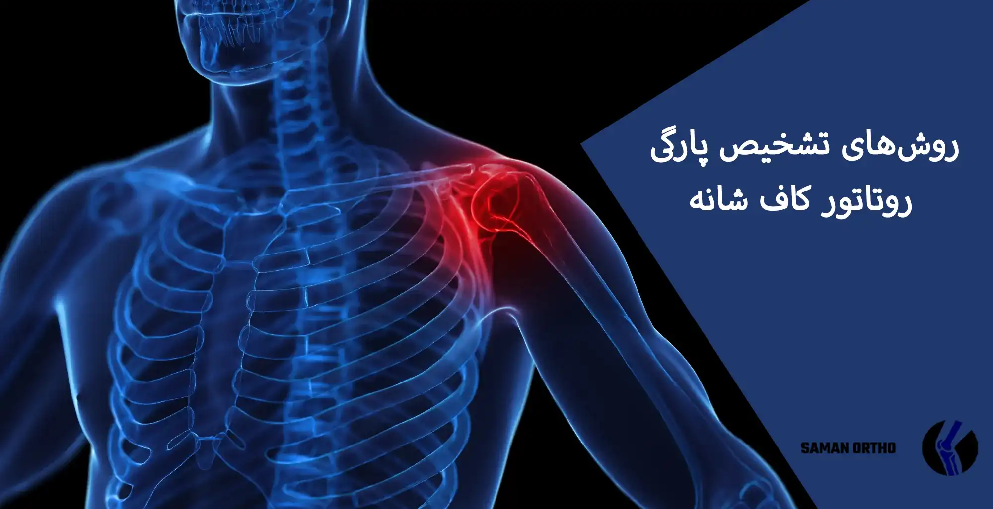 روتاتورکاف شانه و محل پارگی تاندون‌ها در مفصل شانه