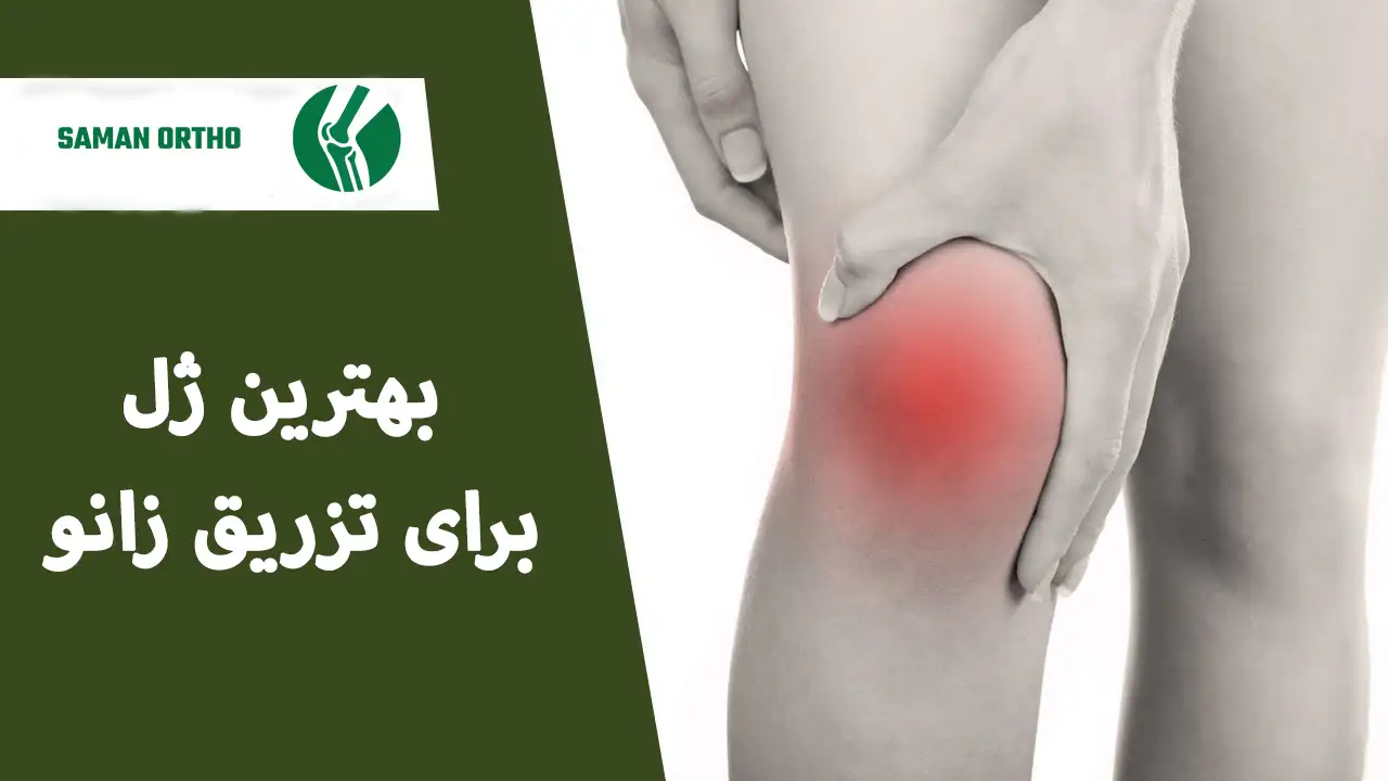 تزریق ژل داخل مفصل زانو بهترین ژل برای تزریق داخل مفصل زانو