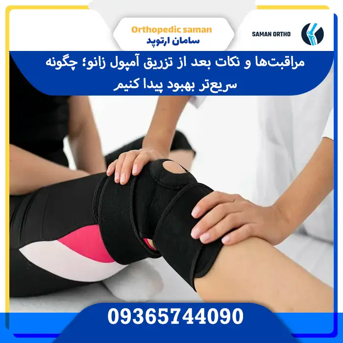 کیا بعد تزریق آمپول زانو بهبود یافتند؟ | راهنمای کامل و جامع برای بیماران عزیز مراقبتها و نکات بعد از تزریق آمپول زانو؛ چگونه سریعتر بهبود پیدا کنیم