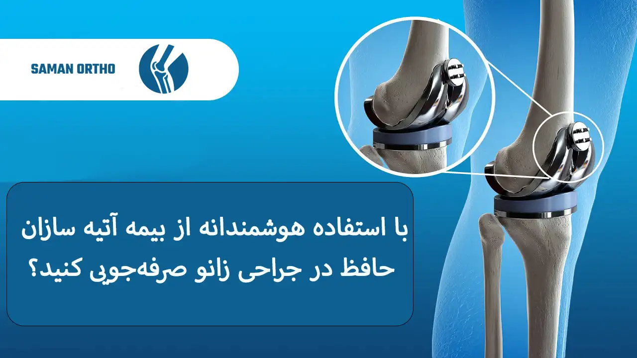 هزینه تعویض مفصل زانو با بیمه آتیه سازان حافظ | همه آنچه قبل از عمل باید بدانید! با استفاده هوشمندانه از بیمه آتیه سازان حافظ در جراحی زانو صرفهجویی کنید؟re