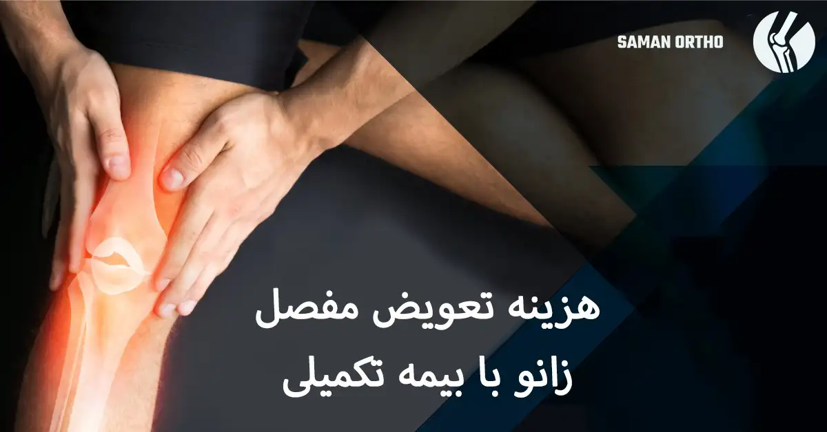 هزینه جراحی تعویض مفصل زانو | آنچه بیماران باید بدانند هزینه تعویض مفصل زانو با بیمه تکمیلی