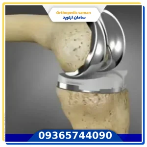 قیمت پروتز زانو