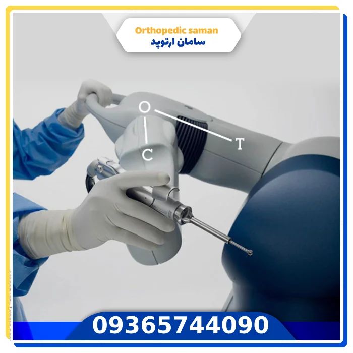 تعویض مفصل زانو با لیزر ، واقعیت پزشکی و روشهای جایگزین عمل لیزری مفصل زانو
