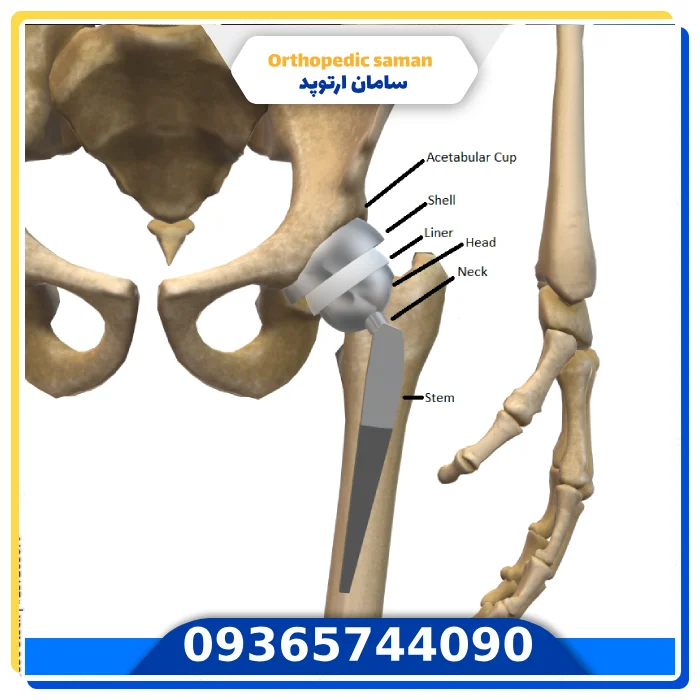 تغیرات djd در زانو