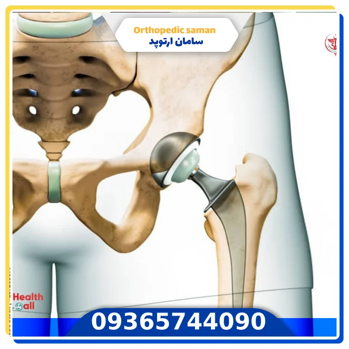 DJD چگونه تشخیص داده می‌شود؟