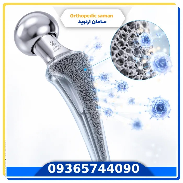 پروتز لگن زیمر آمریکایی